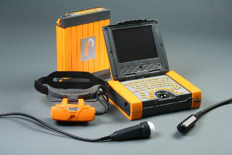 Example of portable ultrasound systems