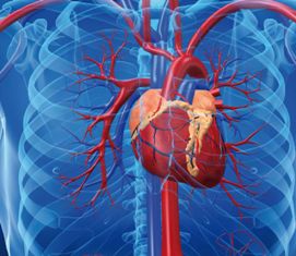 Drawing of the heart and surrounding arteries