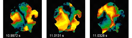 Spatial-temporal excitation pattern during cardiac fibrillation  on the surface of the heart