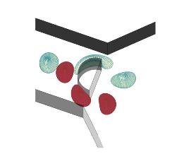 Visualization from a numerical simulation of a cell flowing 
past the obstacle through the microfluidic device.