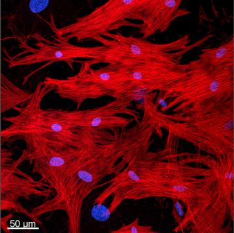 Cellular regression in diseased heart tissue with the help of oncostatin M: the image shows heart muscles under the fluorescence microscope. The myofibrils are stained red, the cell nuclei blue. Credit: MPI for Heart and Lung Research.