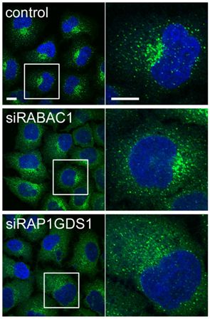 Image shows cells where different genes are silenced