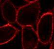 A fluorescent drug (in red) binding to an adenosine receptor on the surface of living cells