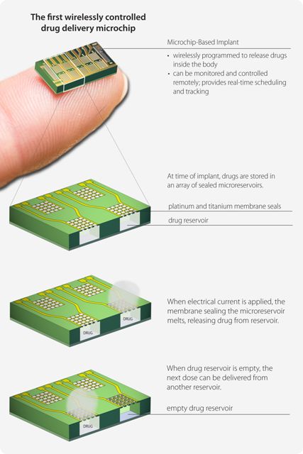 Diagram showing how the programmable chip delivers controlled amounts of drug