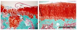 Microscope section of rat cartilage with osteoarthritis. Left, without treatment. Right, with treatment.