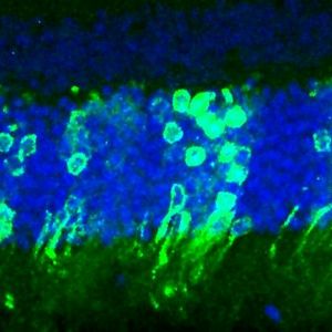 Photoreceptor eye cells