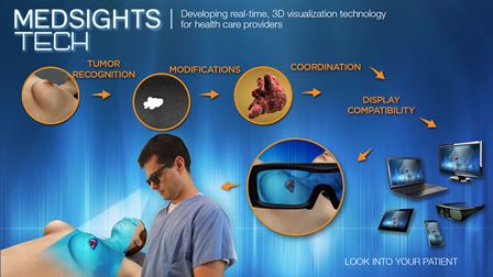 A diagram showing how the technology gives 3D visualisation of a tumour in the patient